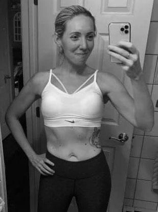Female Body after Gallery Vitality Medical Group