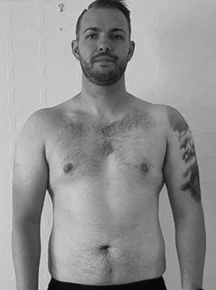 Male Body after Gallery Vitality Medical Group