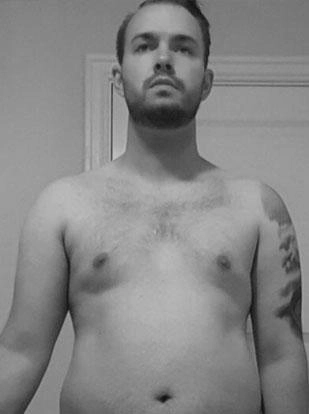 Male Body before Gallery Vitality Medical Group